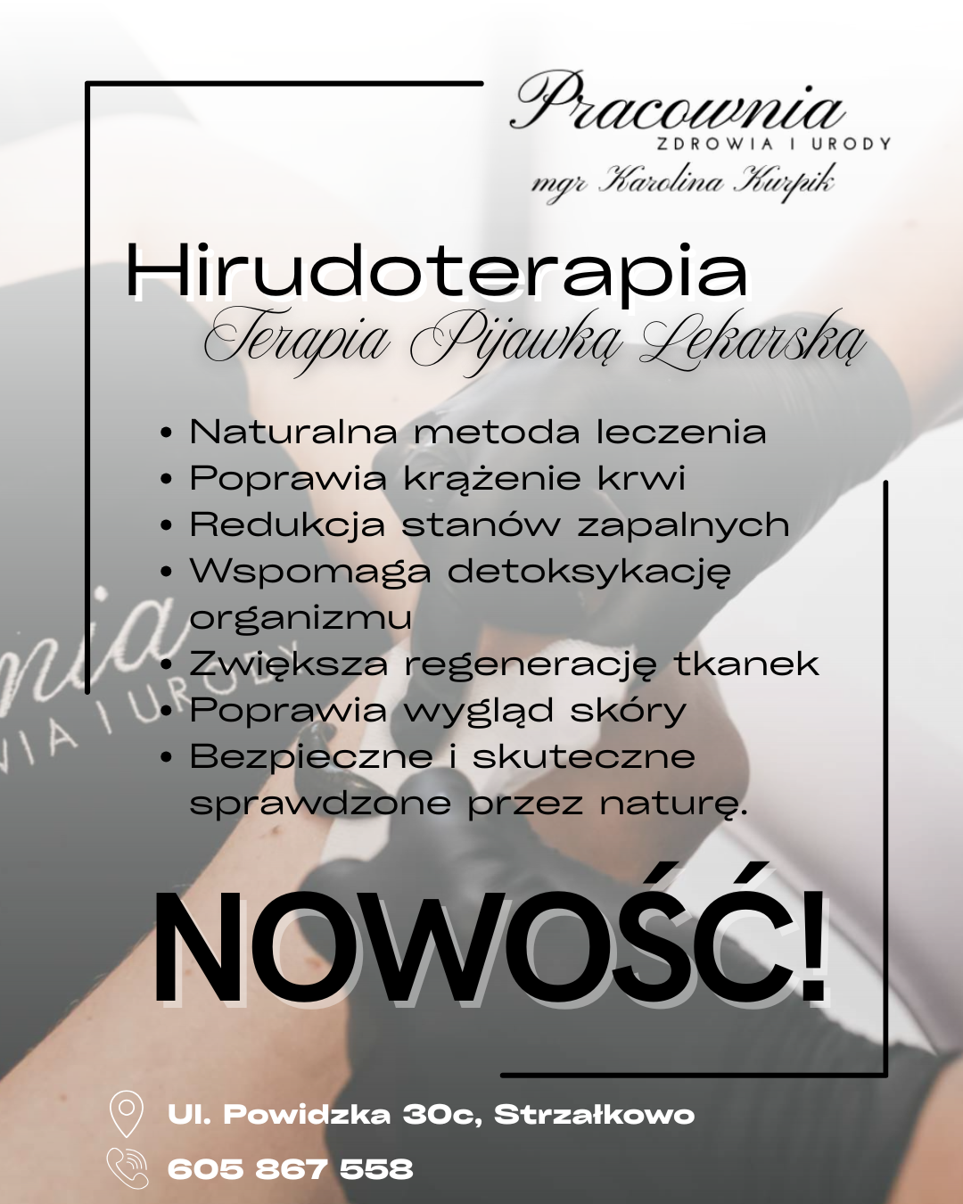 Pijawki Lekarskie Hirudoterapia - 2