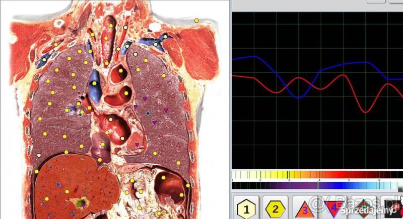 Biorezonans Hunter GR, Vector, Metapathia + Prezent Quantum - 2
